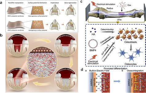  Osseointegration Enhancement Material: Unveiling the Mysteries of Osteoinductive Bioceramic Coating for Superior Bone Repair!